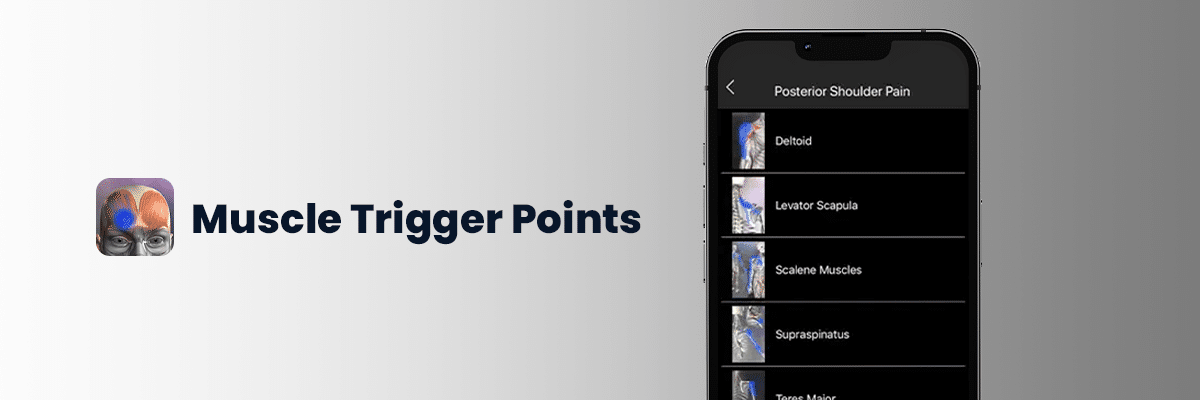 Muscle Trigger Point - Best Medical Diagnosis App